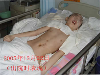 李小勇神经外科脑脊液专业学网站
