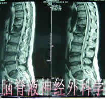 脑脊液神经外科学网站