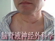 脑脊液神经外科学网站